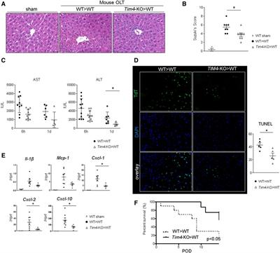 Recipient TIM4 signaling regulates ischemia reperfusion-induced ER stress and metabolic responses in liver transplantation: from mouse-to-human